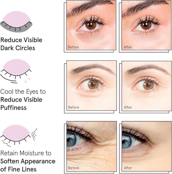 55% OFF on Under Eye Mask - Reduce Dark Circles, Puffy Eyes, Undereye Bags, Wrinkles - Gel Under Eye Patches, Vegan Cruelty-Free Self Care by grace and stella - Image 5