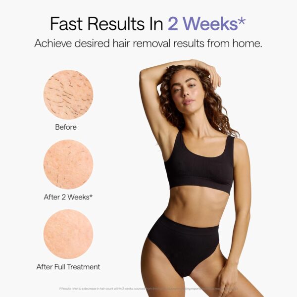 23% Limited Time Deal on Ulike Laser Hair Removal, Air 10 IPL Hair Removal for Women and Men - Image 8